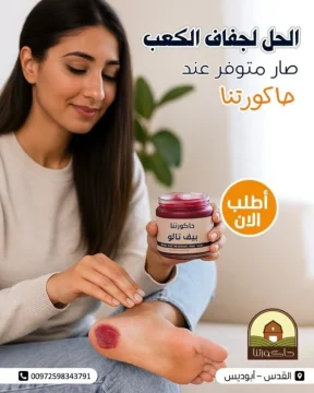 دهون كعب الغزال